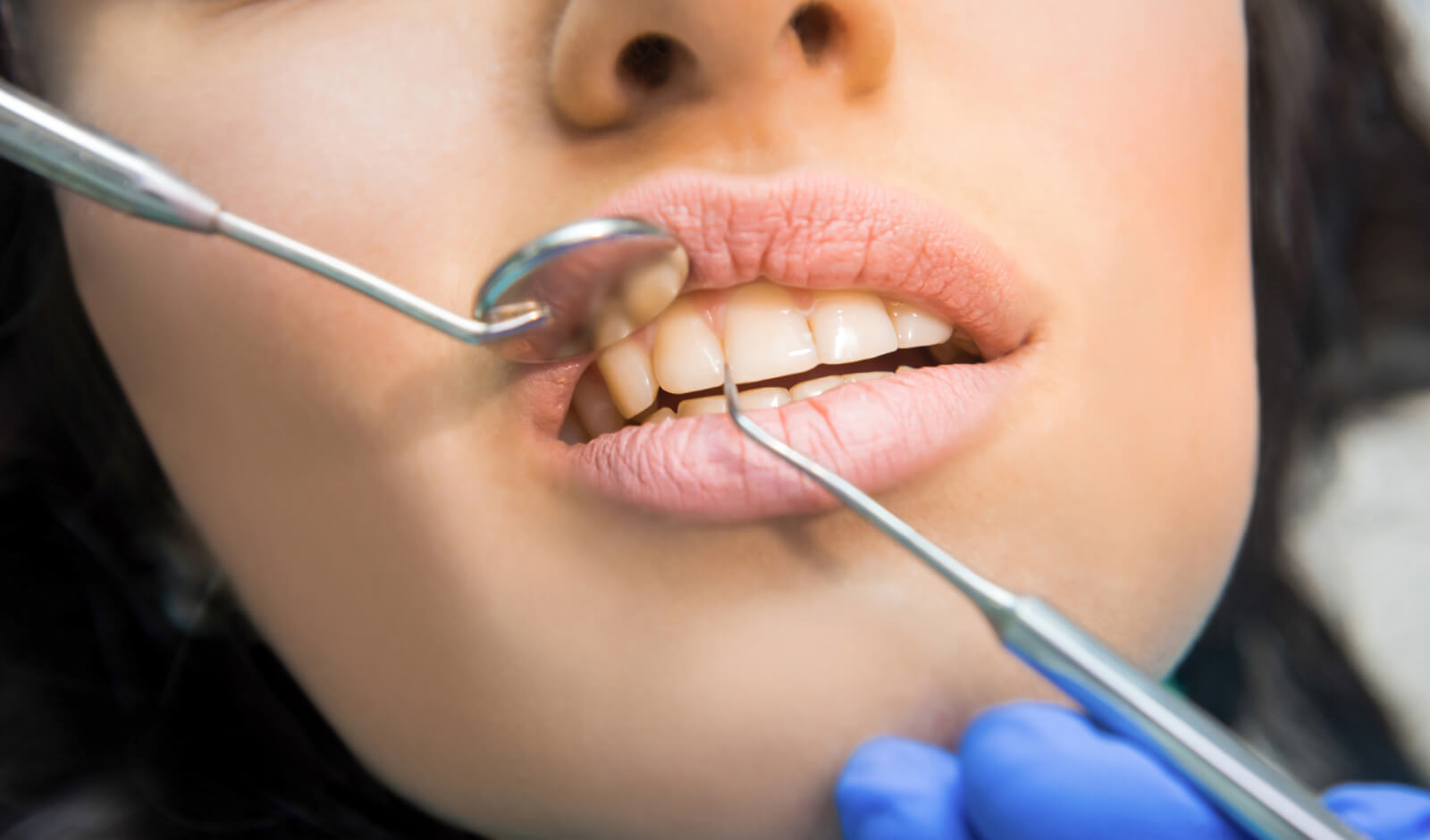 endodoncia clinica dental dentinos
