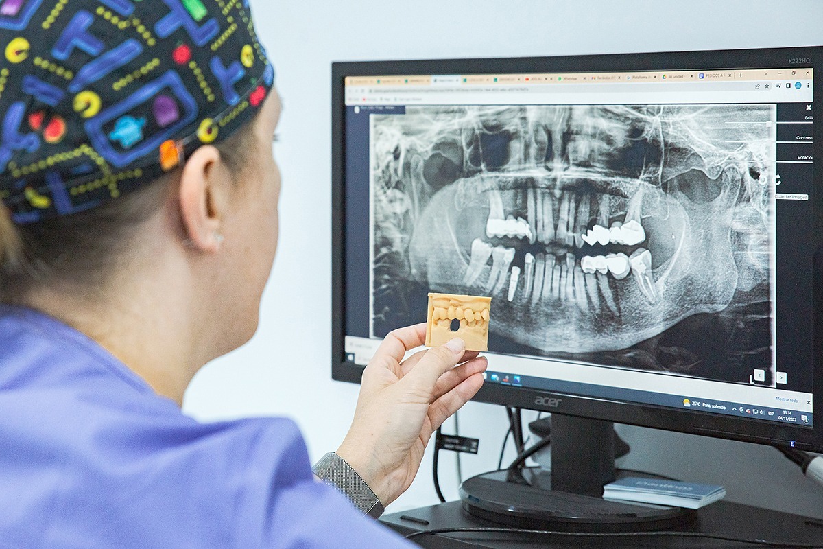 Cirugía oral - Clínica Dental Dentinos clínica dental dentinos radiografía y maqueta bucal