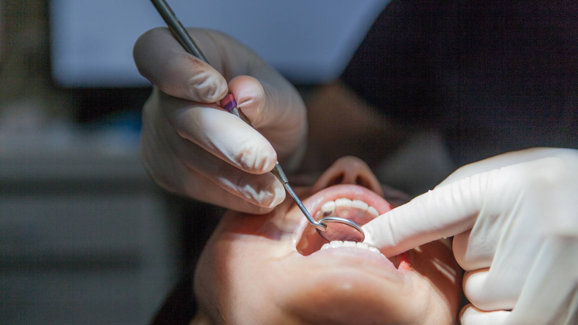 Cirugía oral - Clínica Dental Dentinos cirugia oral clinica dental dentinos