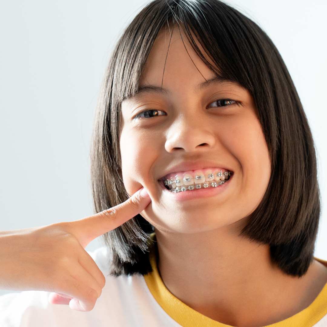 Brackets - Clínica Dental Dentinos brackets de zafiro clinica dental dentinos