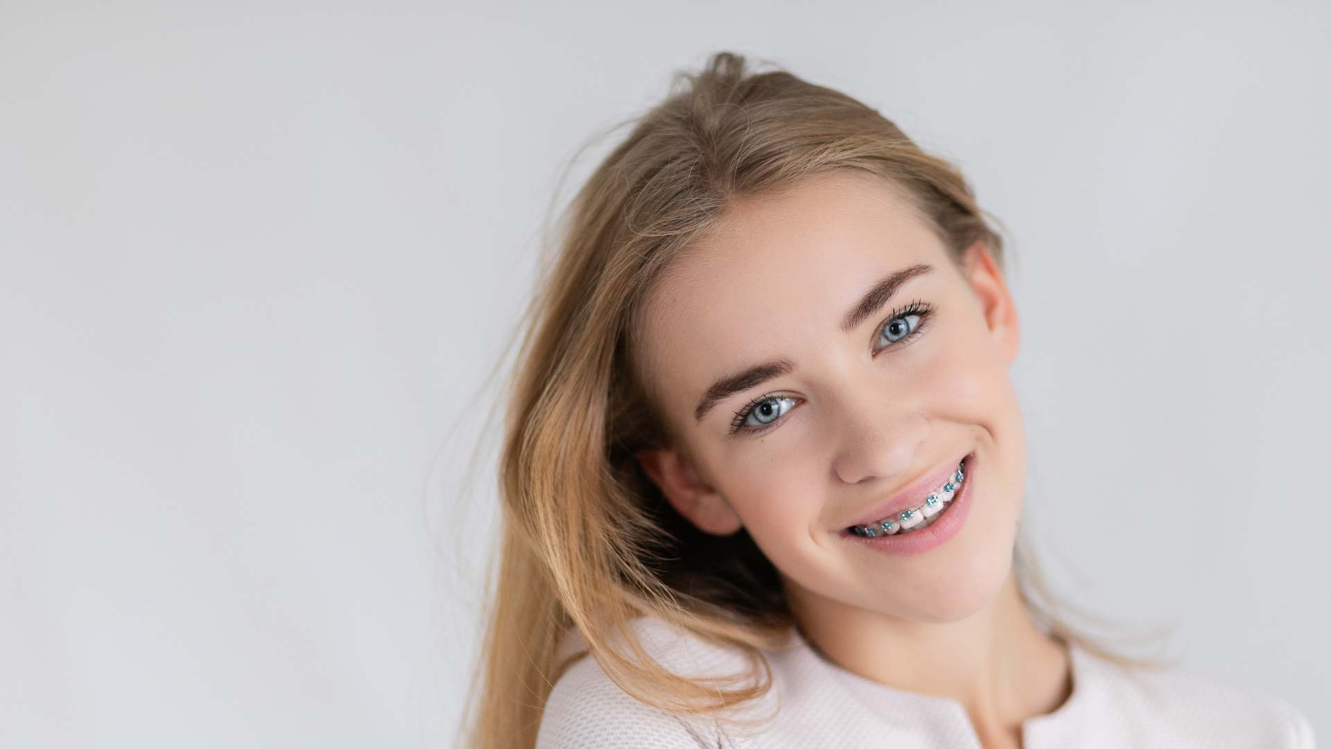 Brackets - Clínica Dental Dentinos brackets clinica dental dentinos