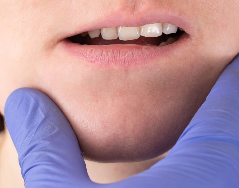 disoclusión dental