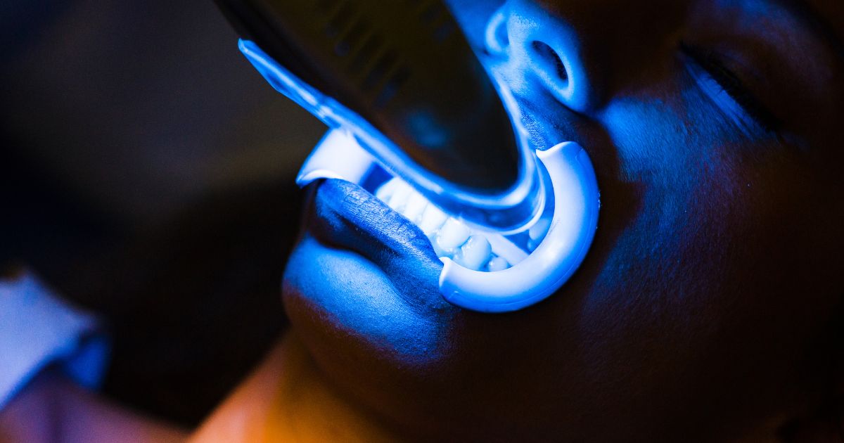 Peróxido de hidrógeno