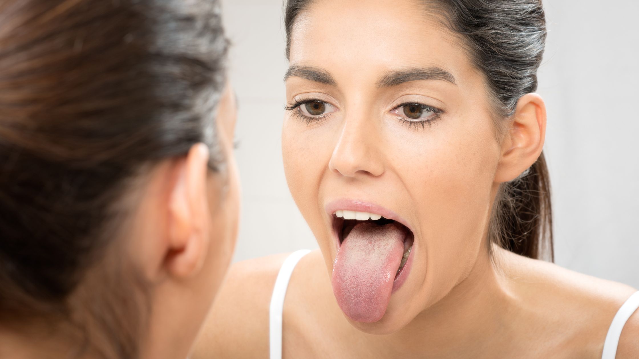 Lengua blanca