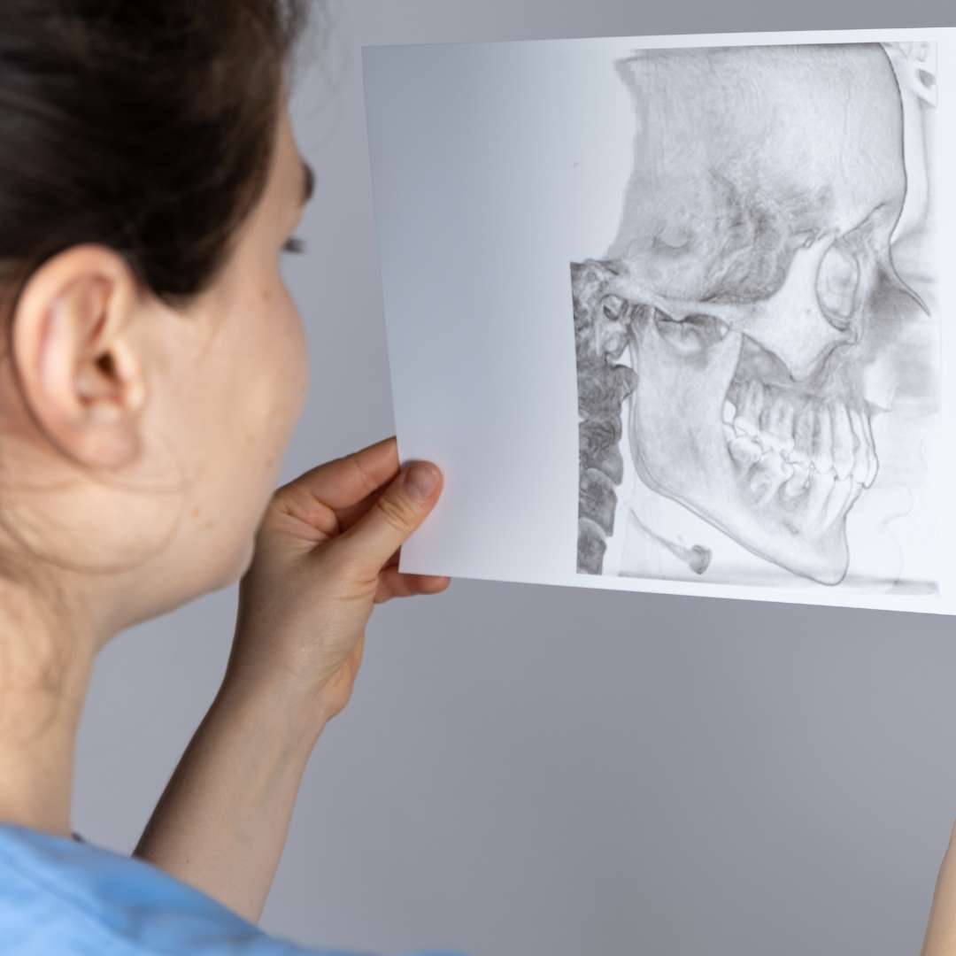Tratamientos de la Disfunción de la Articulación Temporomandibular - Clínica Dental Dentinos articulación temporomandibular atm clinica dental dentinos