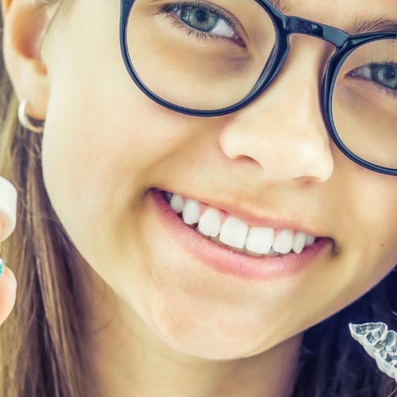 Alineadores vs. brackets