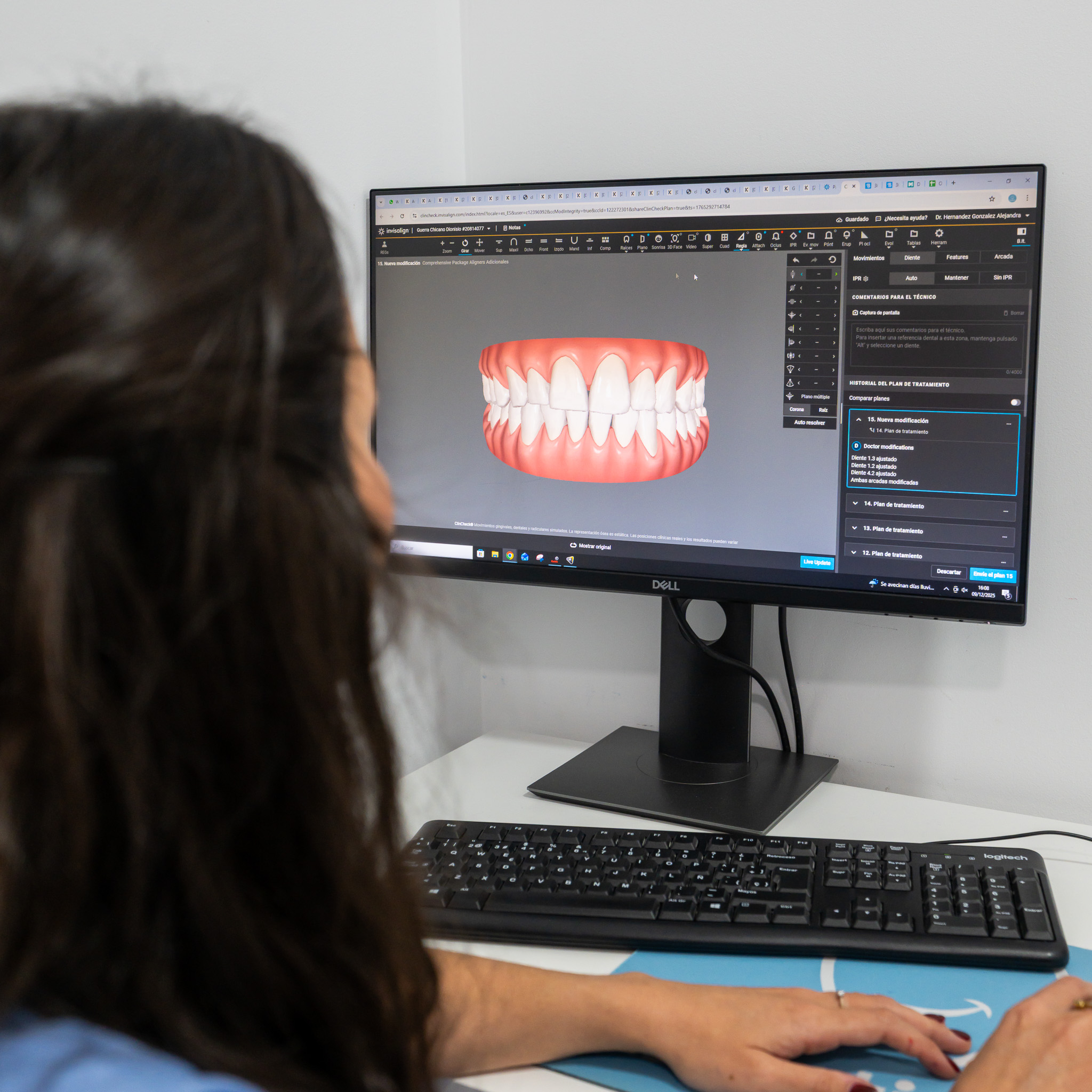 inteligencia artificial en diagnóstico dental