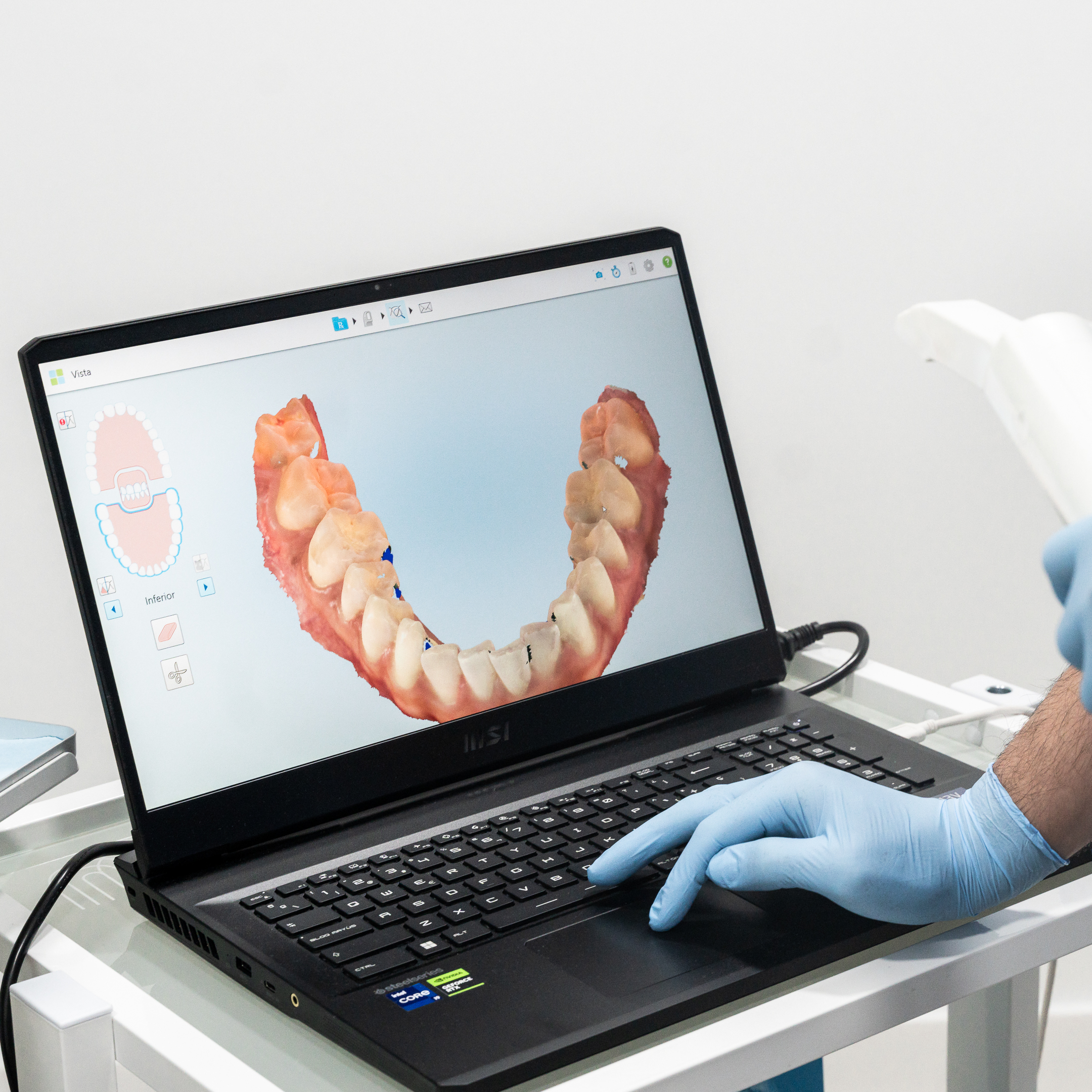 Inteligencia artificial en diagnóstico dental