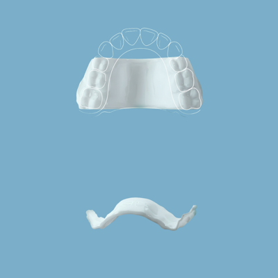 ortodoncia interceptiva