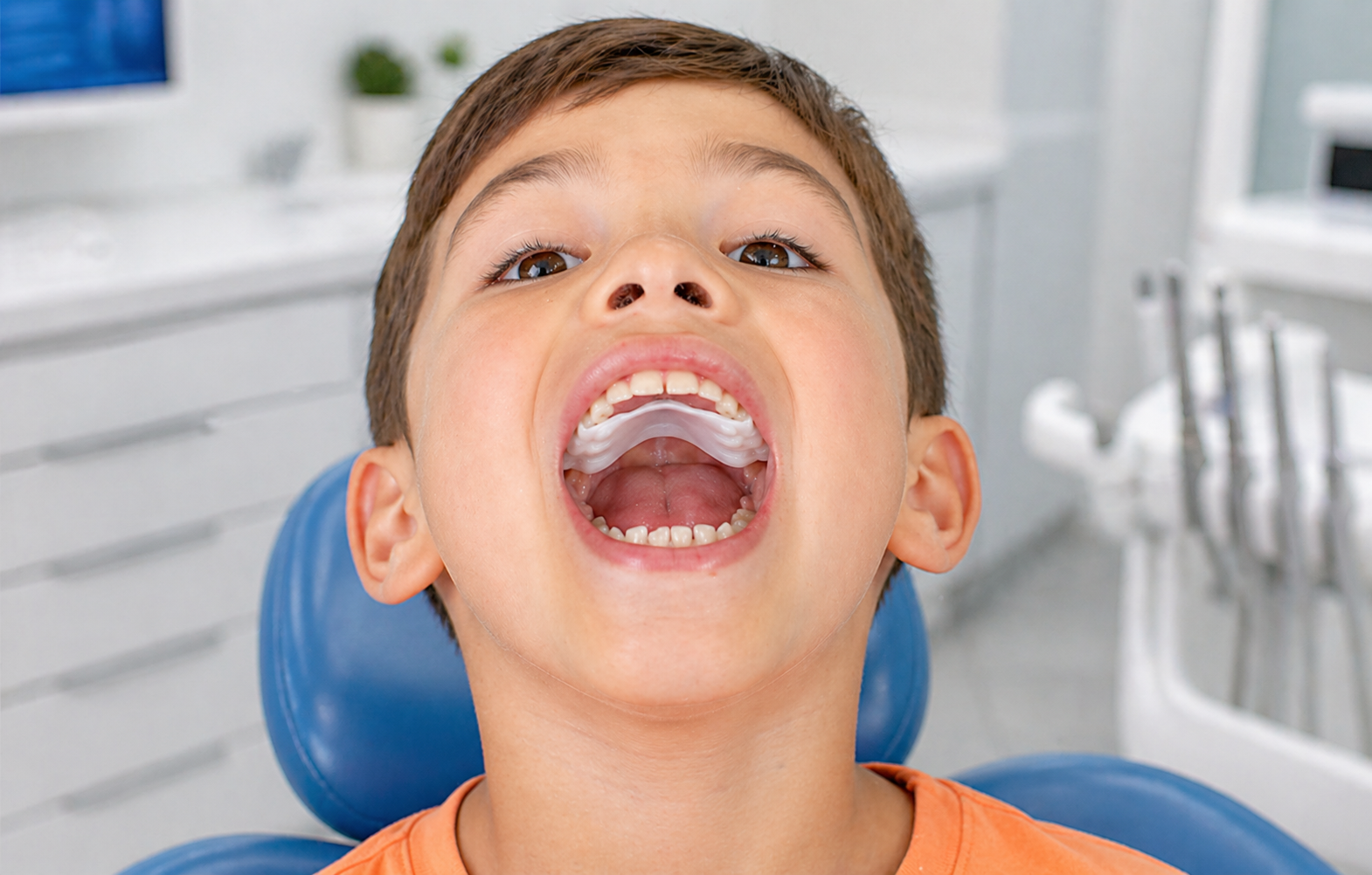 paladar estrecho en niños