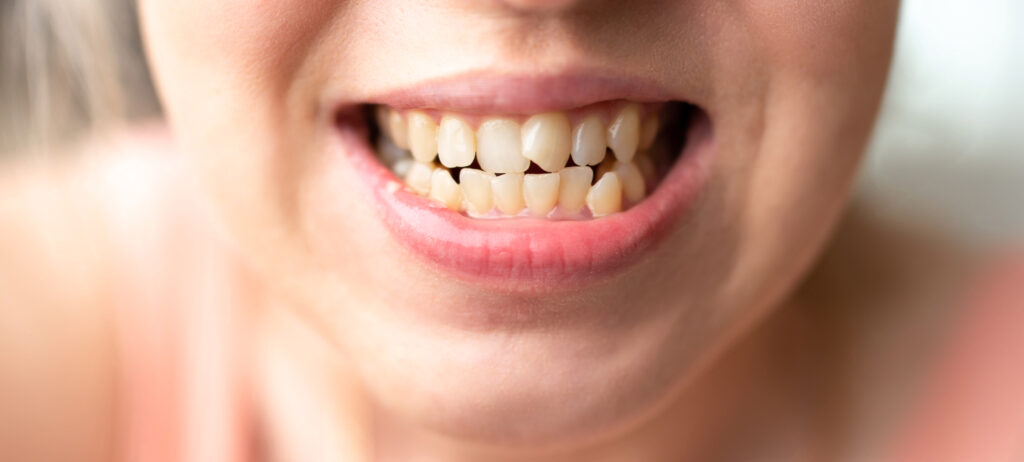 Home - Clínica Dental Dentinos Home - Clínica Dental Dentinos