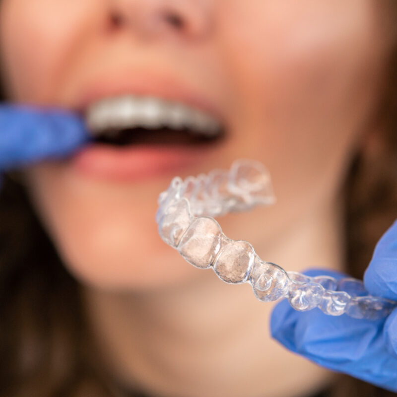 refinamientos Invisalign