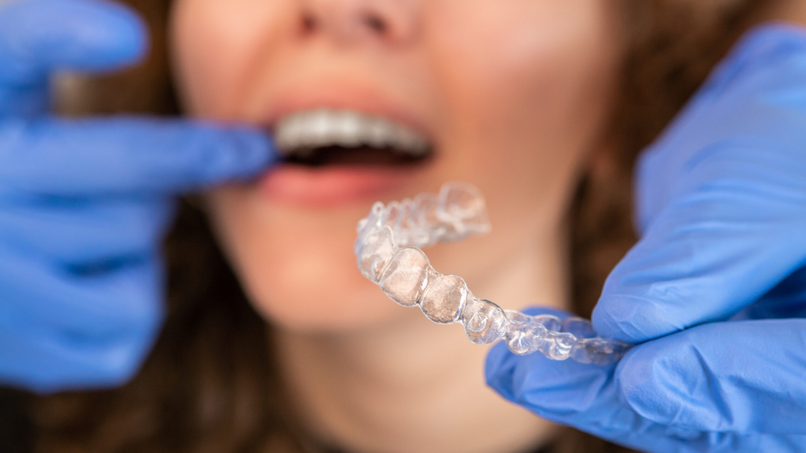 refinamientos Invisalign