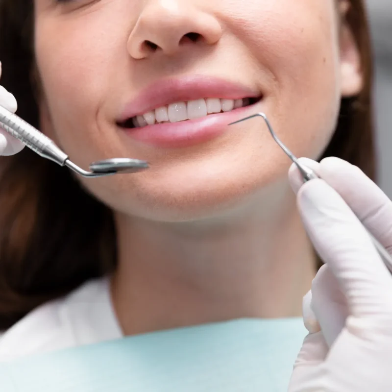 resalte dental