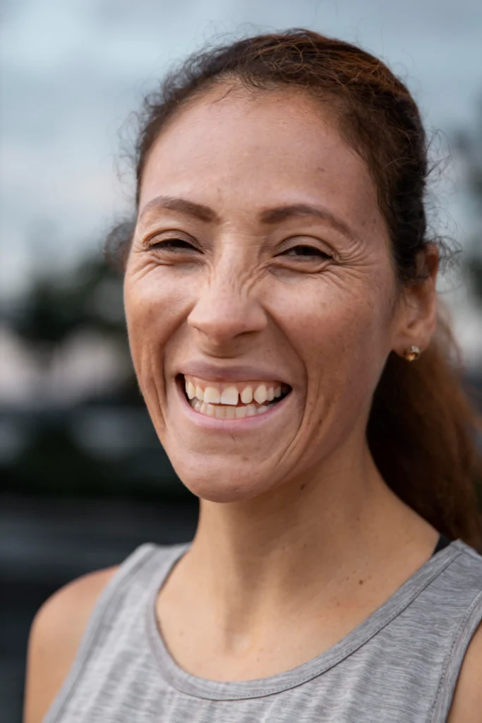 Home - Clínica Dental Dentinos diastema dental