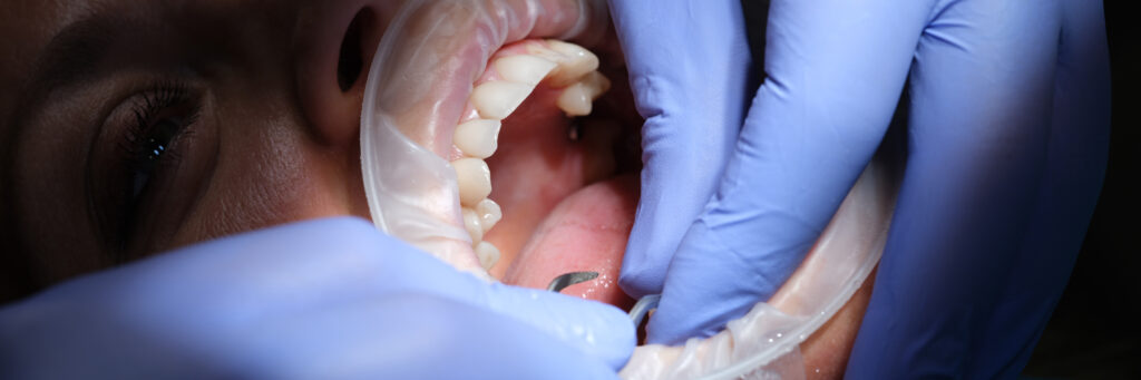 Home - Clínica Dental Dentinos mordida abierta