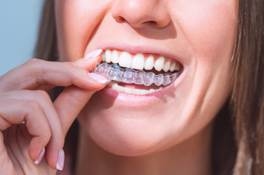 Home - Clínica Dental Dentinos Invisalign casos complejos