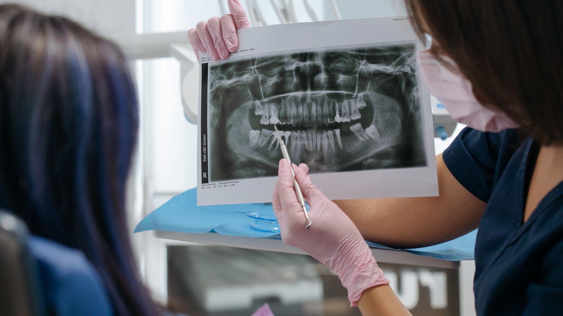 Implantes de carga inmediata - Clínica Dental Dentinos Dentista señala en una radiografía panorámica la zona a tratar mientras la paciente escucha en el sillón
